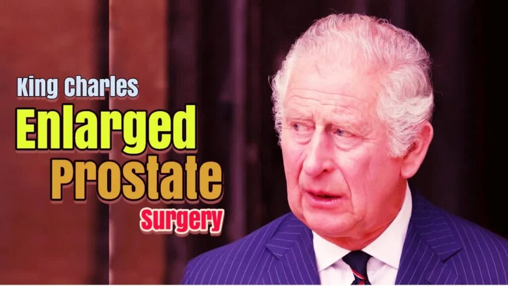 King Charles To Undergo Surgery For Enlarged Prostate Medical