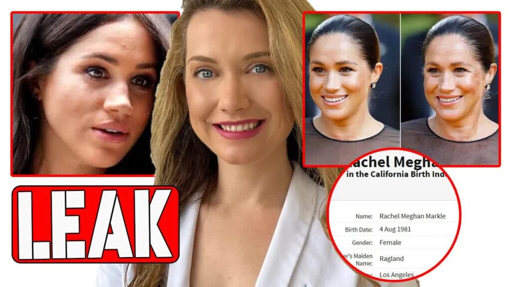 CaliBeautyDoctor Leaks Meghan’s Medical Records, Exposing Her Facelift